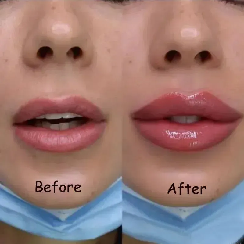 Collagen Lip Plumper Serum